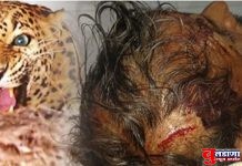 बिबट्याचा हल्ल्यात शेतकरी जखमी;आरडाओरड केल्याने वाचले प्राण